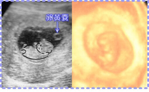 妊娠10週2日の2D画像と3D画像の胎児画像