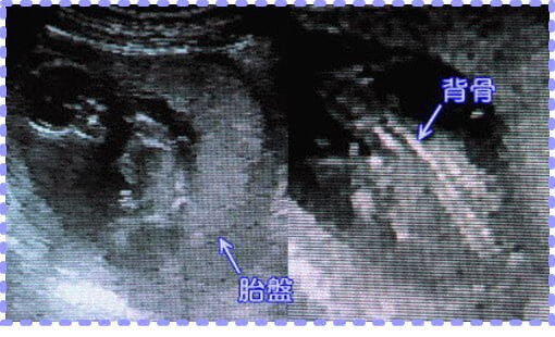 妊娠16週0日の胎児の画像