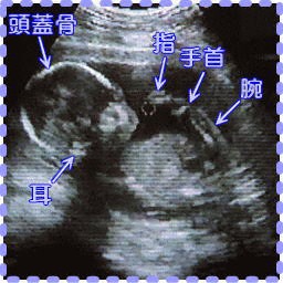 妊娠18週2日の胎児画像