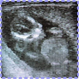 妊娠20週0日の胎児画像