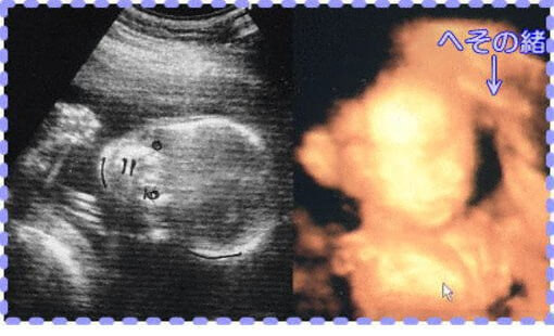 妊娠23週4日の3D・2Dの胎児画像