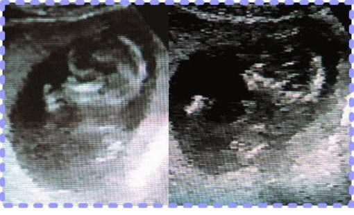 妊娠24週0日の胎児画像