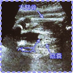 妊娠25週0日の胎児画像