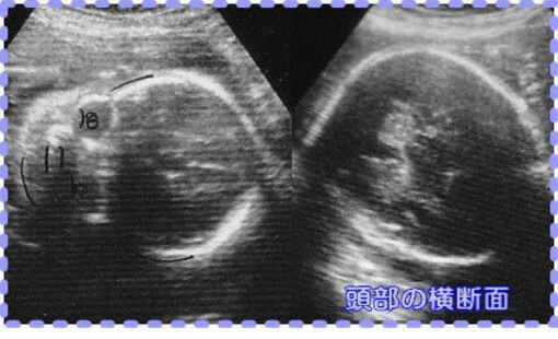 妊娠27週5日の胎児画像
