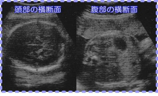 妊娠30週3日の胎児画像