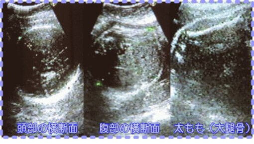 妊娠33週5日の胎児画像