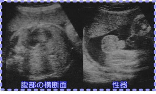 妊娠36週0日の胎児画像