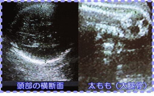 妊娠37週1日の胎児画像