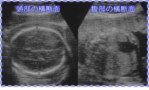 妊娠28週3日の胎児画像