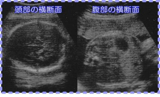 妊娠30週3日の胎児画像
