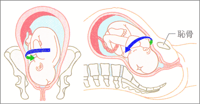 胎児の第2回旋